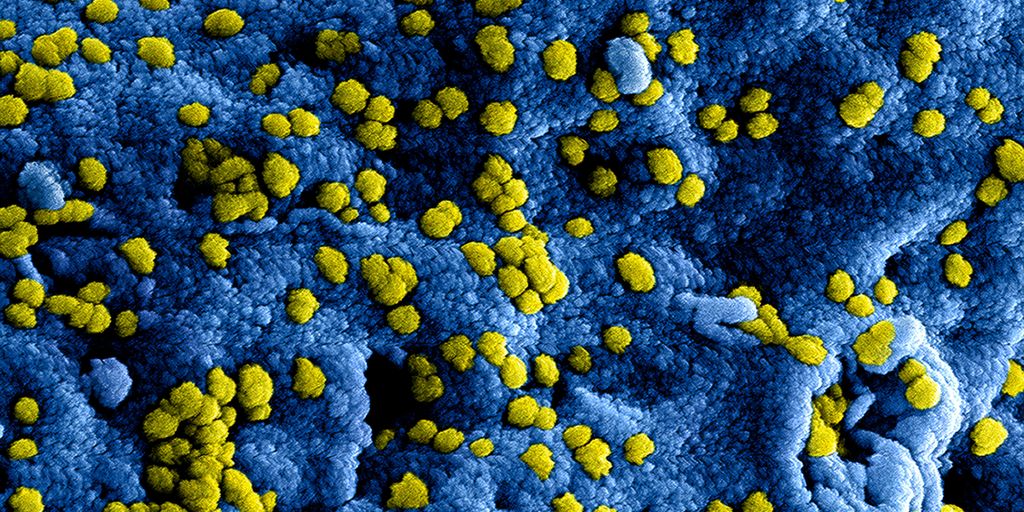 yellow flower petals on blue textile
